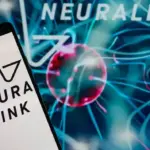 Chip Neuralink Malafungsi